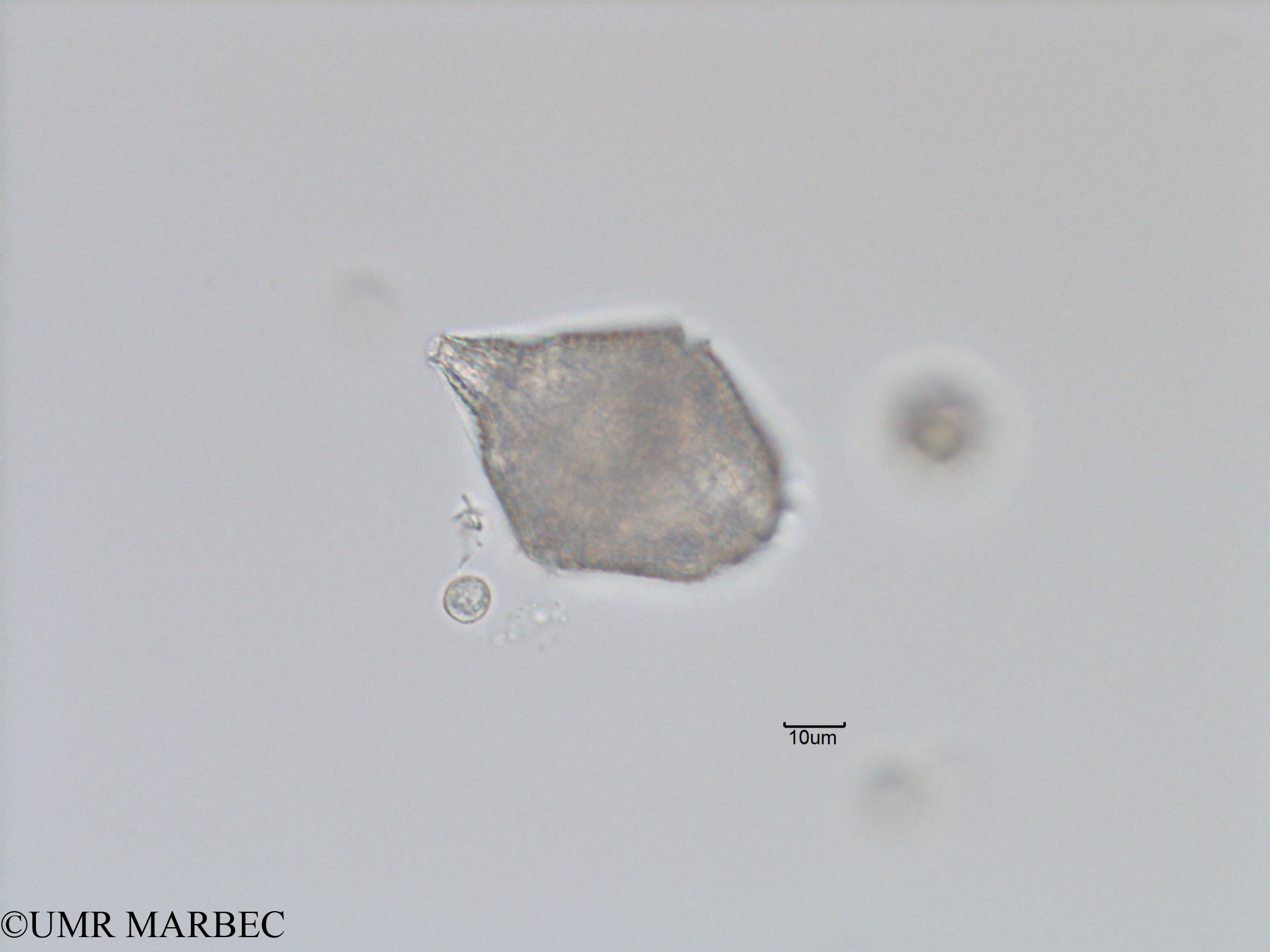 phyto/Bizerte/bizerte_bay/RISCO November 2015/Gonyaulax digitale (Baie_T5-C2-3 Gonyaulax spinifera-12).tif(copy).jpg